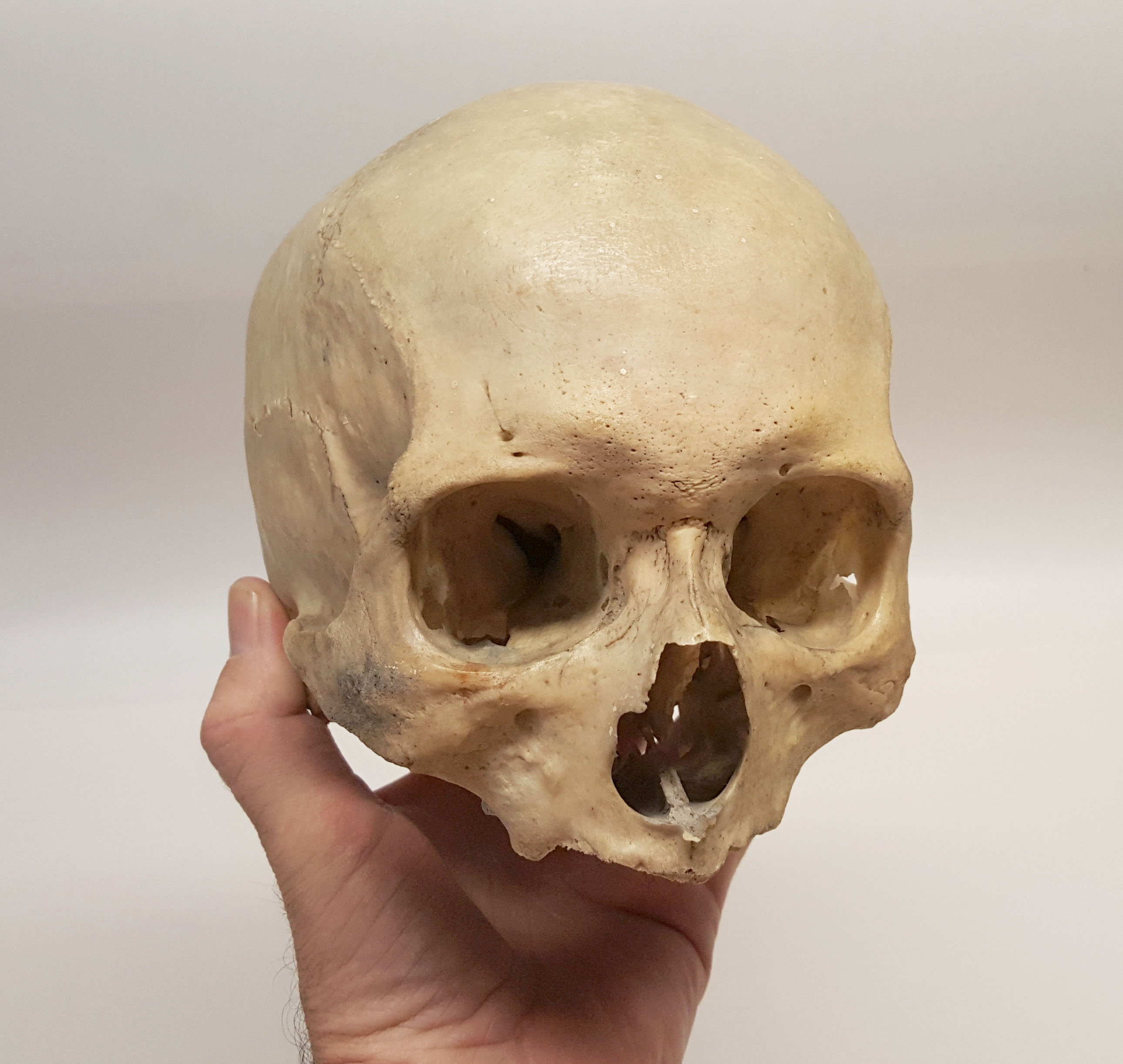 SKULL